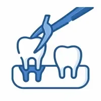 Tooth Extraction